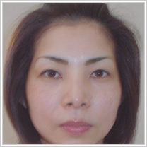 �A�[�g���C�N�{�p��