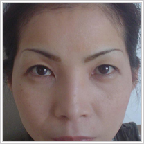 �A�[�g���C�N�{�p�A2������